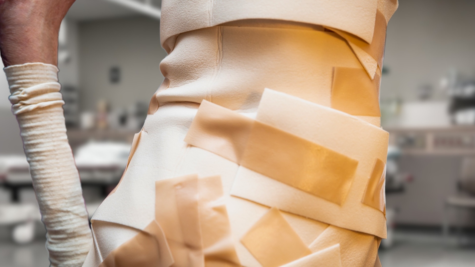 پانسمان بیماران پروانه ای