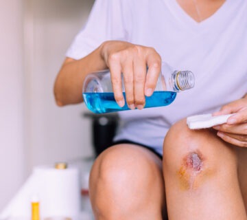 عکس عفونت زخم دیابتی