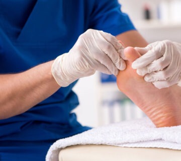 دیر خوب شدن زخم های سطحی