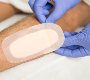 پانسمان های سیلیکونی غیر چسبنده