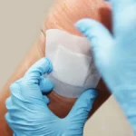 پانسمان هیدروژل