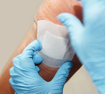 پانسمان هیدروژل