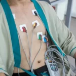 اجاره هولتر ریتم قلب