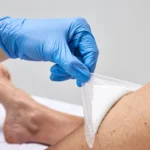 پانسمان فوم